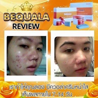 ครีมบีควอล่า(bequala) ชุดทดลอง เปลี่ยนหน้าสิวให้เป็นหน้าใสเห็นความเปลี่ยนแปลงภายใน 7 วัน !! ราคา 300 บาท