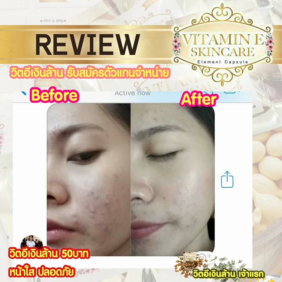 วิตามินอี บำรุงผิวหน้า Vitamin E Skincare by Nifty