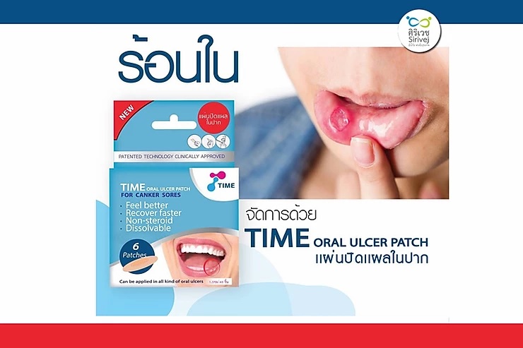 TIME Oral Ulcer Patch แผ่นปิดแผลในปาก 6 ชิ้น