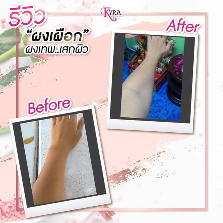 Alpha Arbutin 3Plus by Kyra อัลฟ่า อาร์บูติน ทรี พลัส ผงเผือก โฉมใหม่!!
