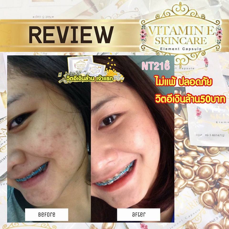 วิตามินอี บำรุงผิวหน้า Vitamin E Skincare by Nifty