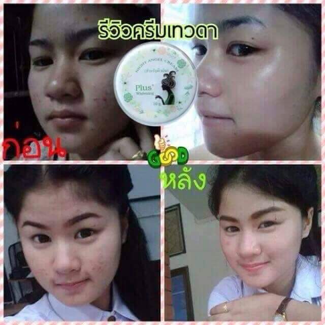 Night Angel Cream Plus Whitening 10 g. ครีมเทวดา ลดสิว ลดริ้วรอย ลดฝ้า กระ จุดด่างดำ