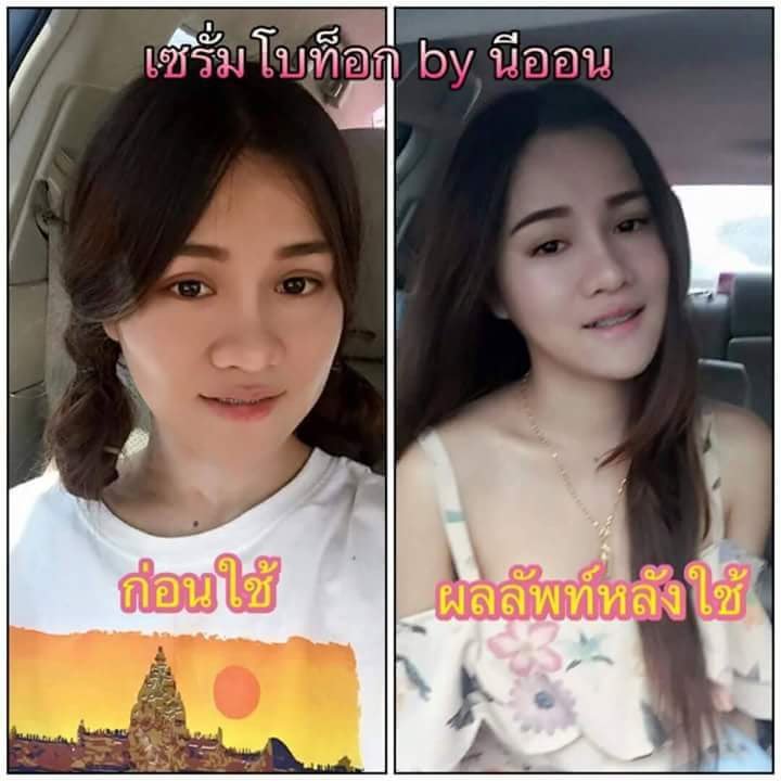 เซรั่มโบท๊อก by นีออน (Botox&Hyaluronic)