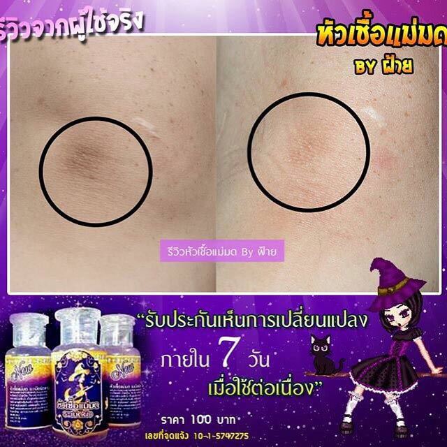 หัวเชื้อแม่มด ระเบิดผิวขาว ขวดละ ราคา 40 บาท โหลละ 30 บาท