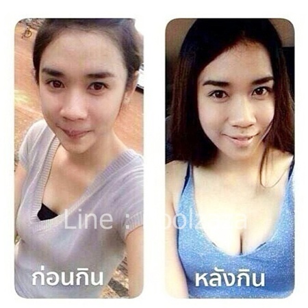 ยานมชมพูสูตรแรง ยานมโต ยานมคลินิก ยานมใหญ่ ยาอกใหญ่ ยานมใหญ่ตัวหอม ขยายหน้าอก อกอึ๋ม ยานมโตอกอึ๋ม เพิ่มอก เพิ่มนม สูตร 2 สอง สีชมพู ยานมกระเทย กลิ่นตัวหอมเย้ายวน น้องสาวฟิตกระชับ แนะนำ ยานม by JAR Si.Ka ยาเพิ่มขนาดทรวงอก ยานมโต ยานมใหญ่ ยานมชิด ยาอัฟไซด์น