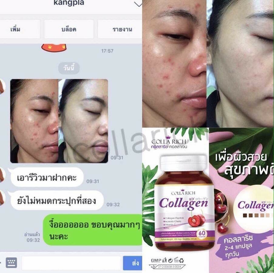 Colla Rich Collagen คอลลาริช คอลลาเจน