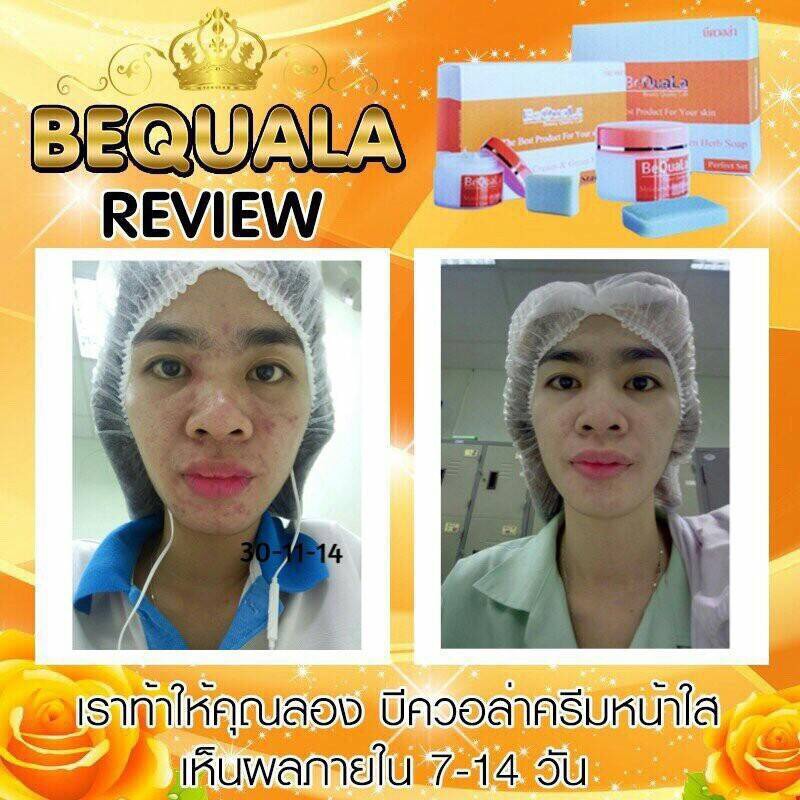 ครีมบีควอล่า(bequala) ชุดทดลอง เปลี่ยนหน้าสิวให้เป็นหน้าใสเห็นความเปลี่ยนแปลงภายใน 7 วัน !! ราคา 300 บาท