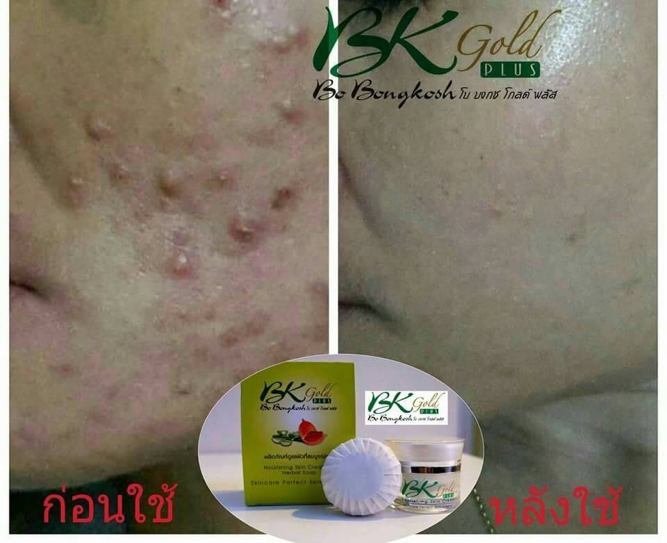 Bo Bongkosh Gold Plus โบ บงกช โกลด์ พลัส ผลิตภัณฑ์ดูแลผิวที่สมบูรณ์แบบ