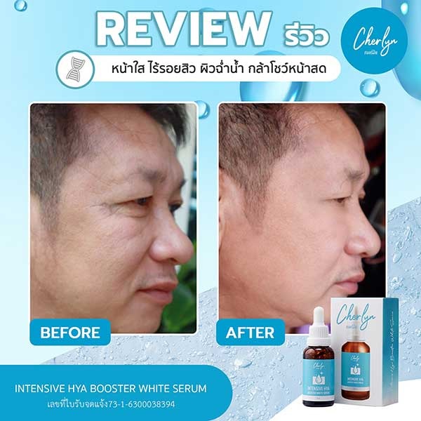 Charlyn Serum รีวิว, เฌอร์ลีน เซรั่ม รีวิว