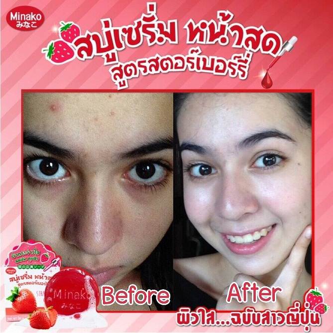 Minako Strawberry Serum Soap สบู่เซรั่มหน้าสด สตรอเบอรี่