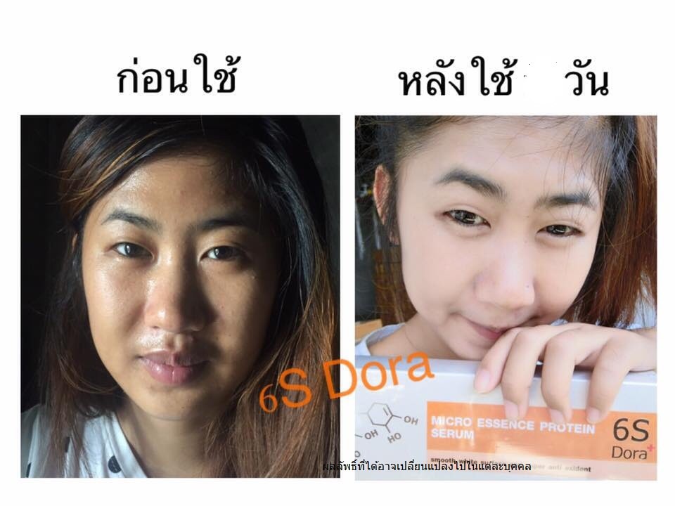 Dora micro essence protein Serum