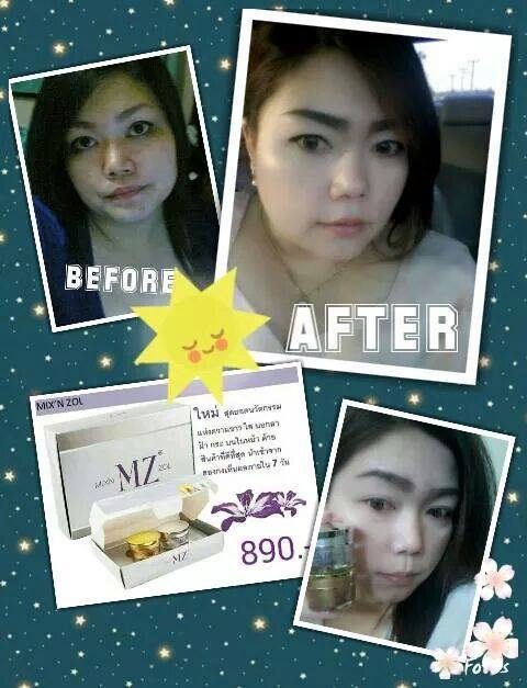 Minzol Cream ครีมมินโซว ราคา 450 บาท Line : fujimate