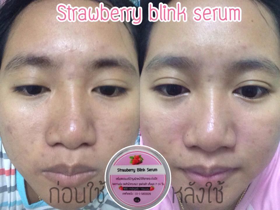 Strawberry Blink Serum 10 g. เซรั่มสตรอเบอร์รี่หน้าใส ลดสิว ผิวขาวใส