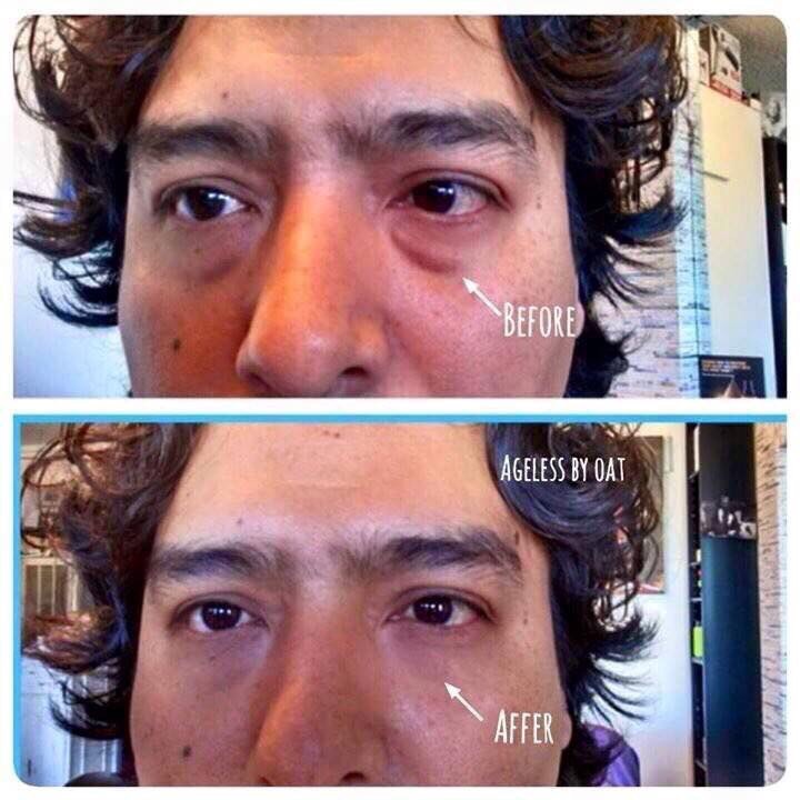 Instantly Ageless อินสแตนลี่ เอจเลส