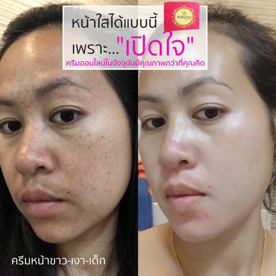 ครีมหน้าขาว หน้าเงา หน้าเด็ก