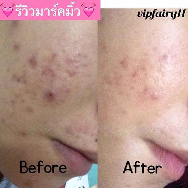 แฟร์รี่ ไนท์มาร์ค มาร์คมิลค์ (Fairy Night Mask By Milkyyrcd)