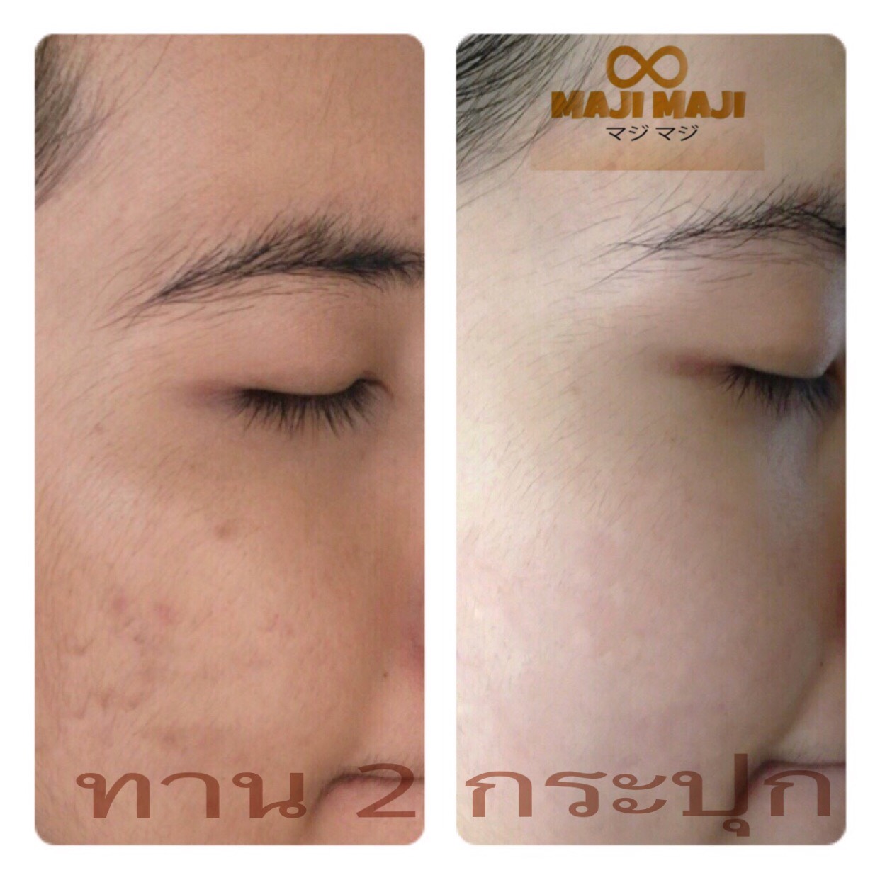 MAJI MAJI Premium Pure Collagen Mineral Flavour มาจิมาจิ คอลลาเจนน้ำแร่ คอลลาเจนโกงอายุ คอลลาเจนหน้าเด็ก