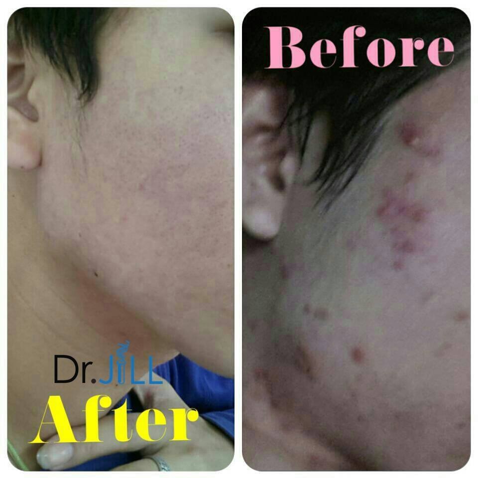 Dr.JiLL G5 Essence