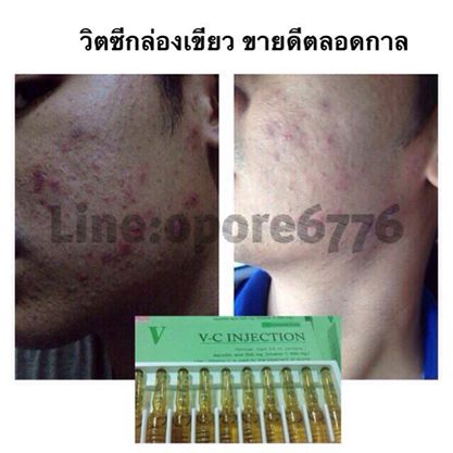 วิตามินซีชนิดน้ำ กล่องเขียว ทาหน้า พอกหน้า แจ๋วสุด!! 1กล่อง บรรจุ10หลอด
